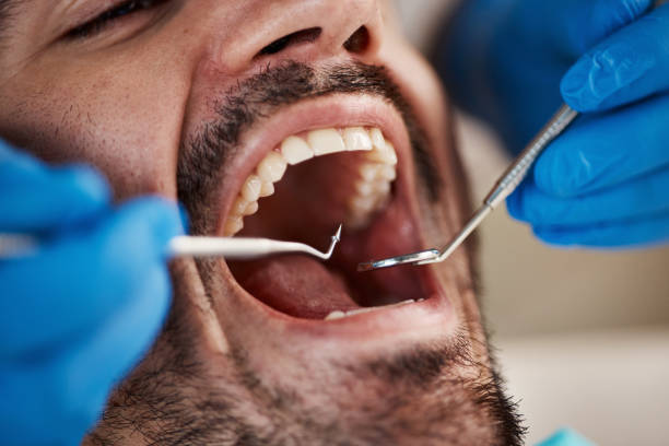 Best Residential Dentistry  in Mount Vernon, IN